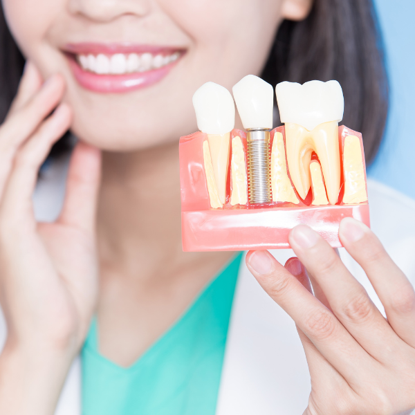 Dental Implants