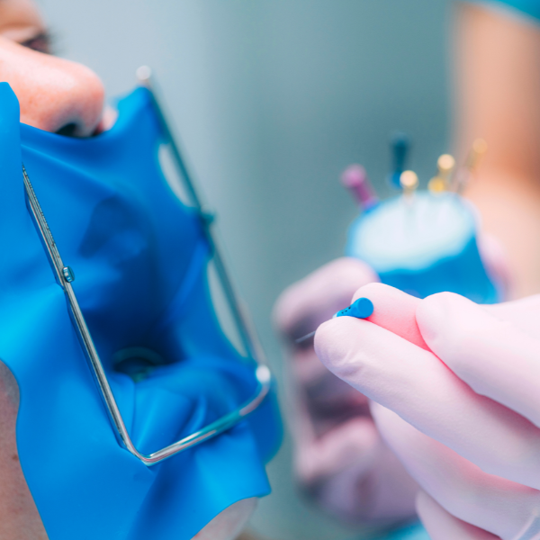 Root Canals & Endodontics